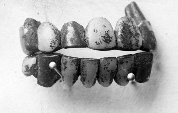 Belle Gunness teeth found in the fire