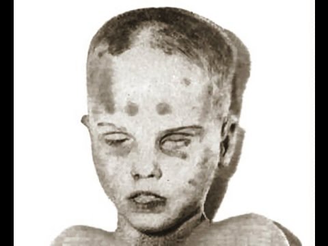autopsy, post mortem photo of the boy in the box